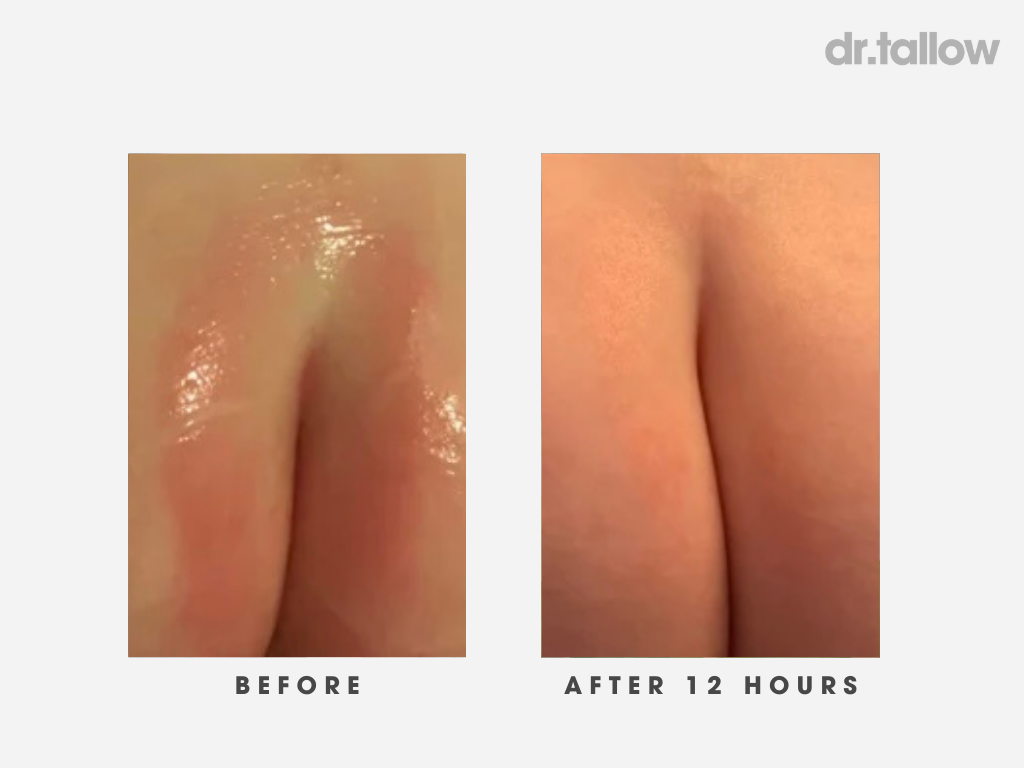 Instant Repair Tallow Balm Stick