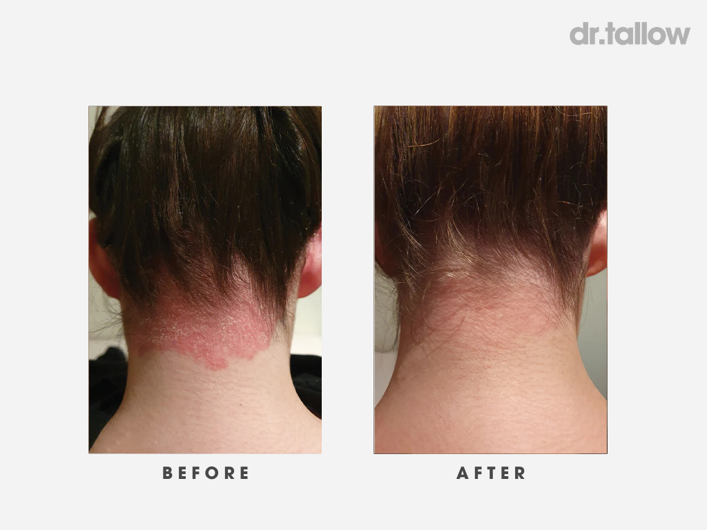 The Original Tallow Balm