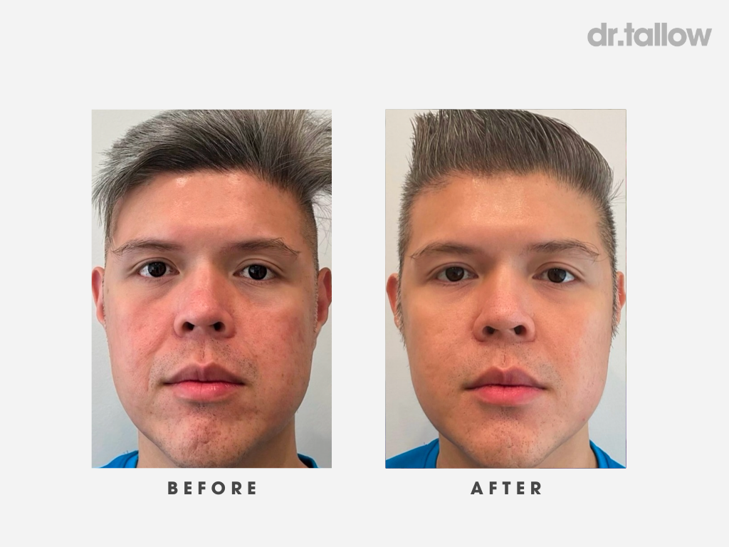 Anti-Aging Tallow Face Cream Men