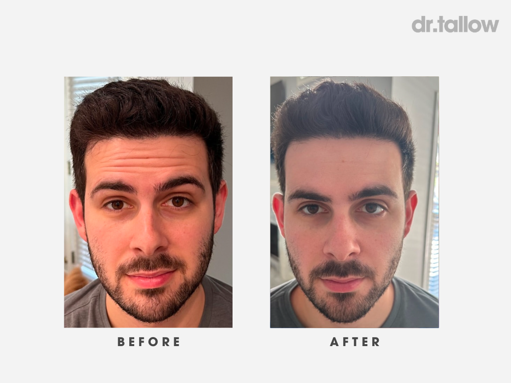 Anti-Aging Tallow Set Men