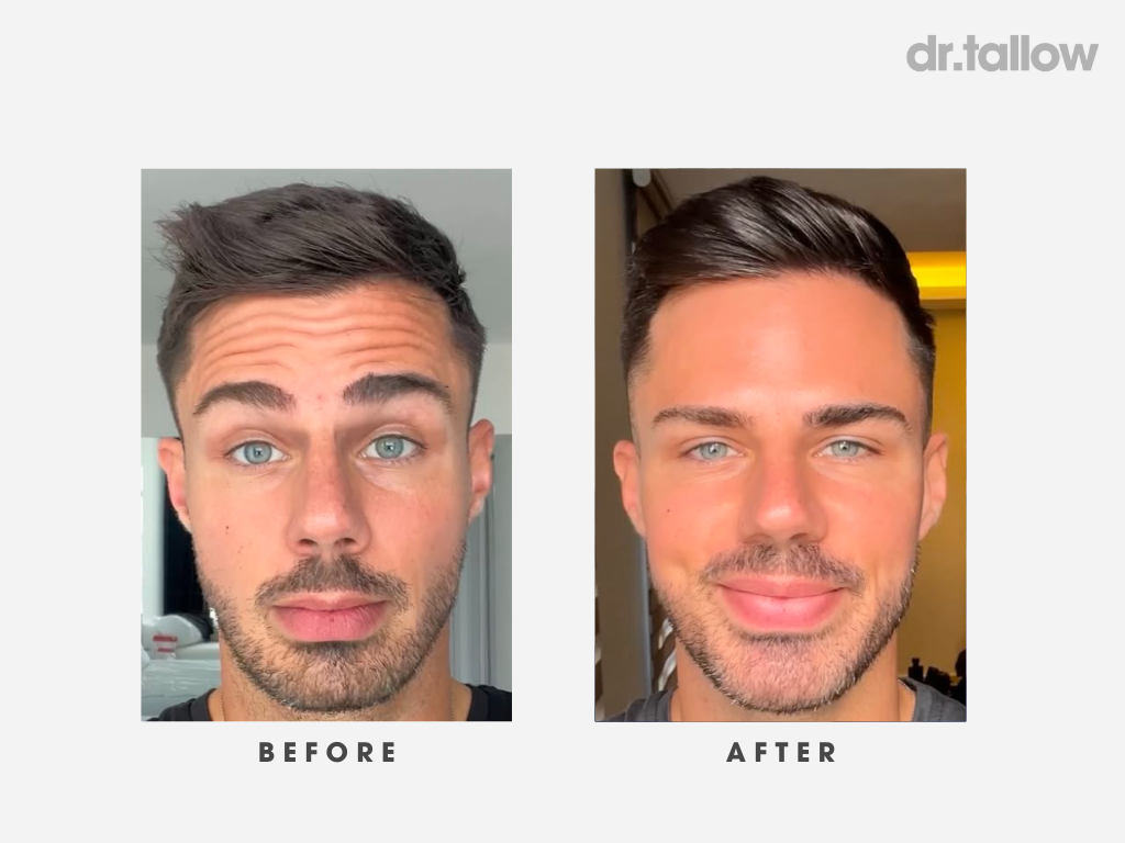 Anti-Aging Rich Tallow Serum Men