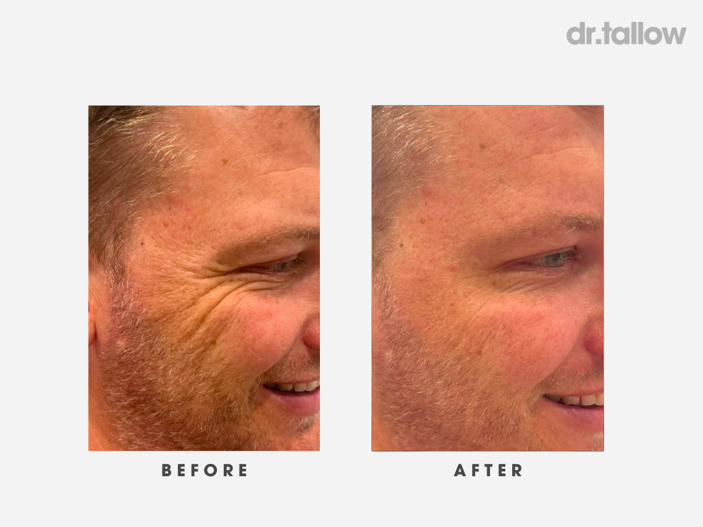 Anti-Aging Tallow Face Cream Men