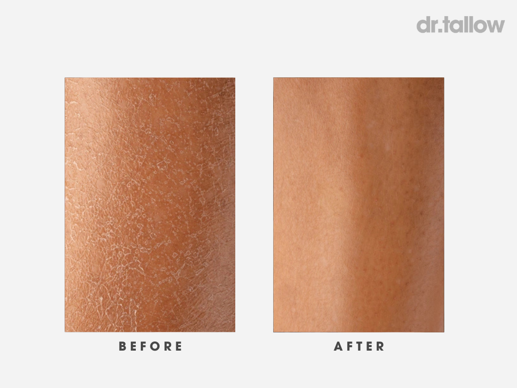 Instant Repair Tallow Balm Stick