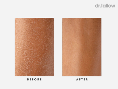 Instant Repair Tallow Balm Stick