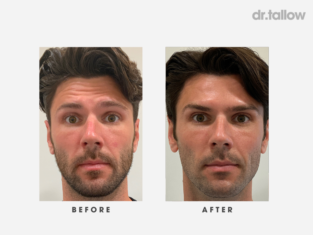 Anti-Aging Tallow Face Cream Men