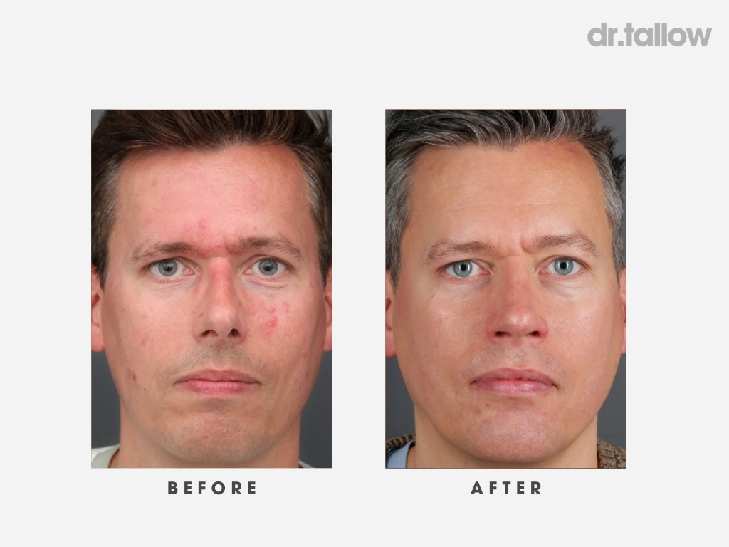 The Original Tallow Balm