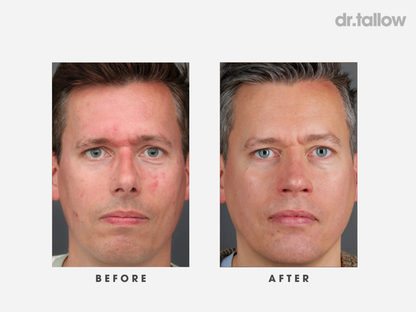 The Original Tallow Balm