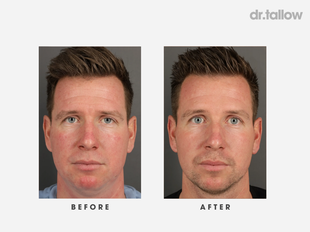 Anti-Aging Tallow Face Cream Men