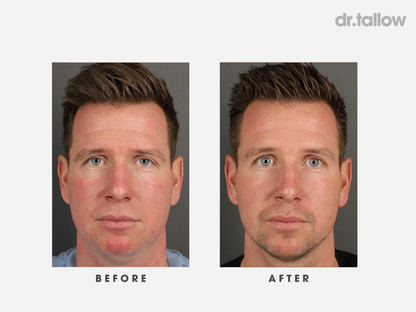 Anti-Aging Tallow Face Cream Men