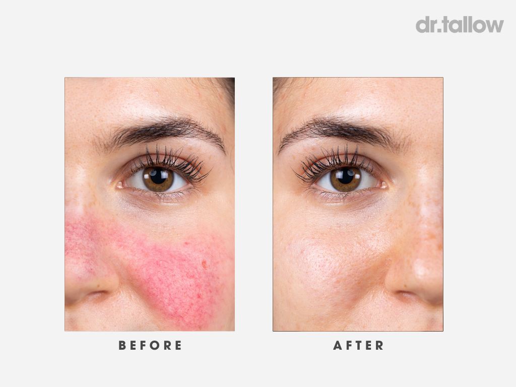 The Original Tallow Balm