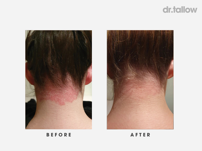 Instant Repair Tallow Balm Stick