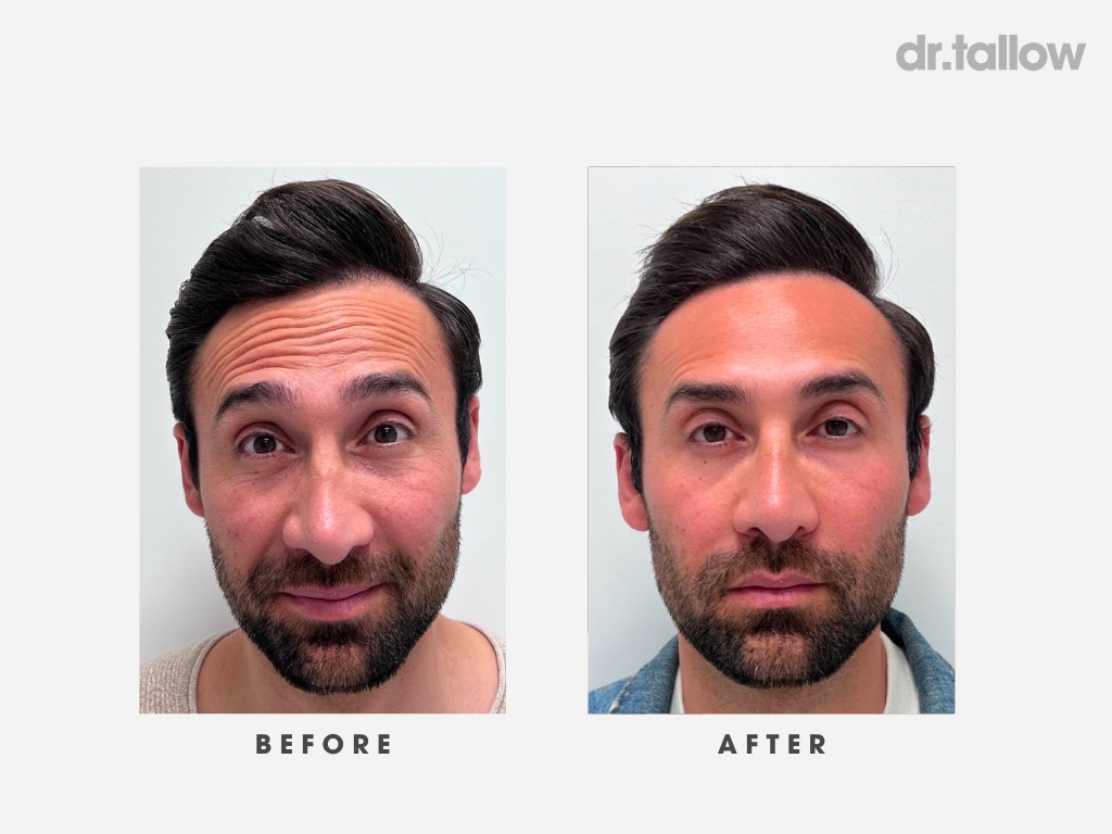 Anti-Aging Rich Tallow Serum Men