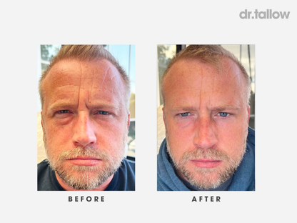 Anti-Aging Tallow Set Men