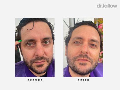 Anti-Aging Tallow Set Men