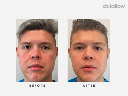 Anti-Aging Tallow Set Men