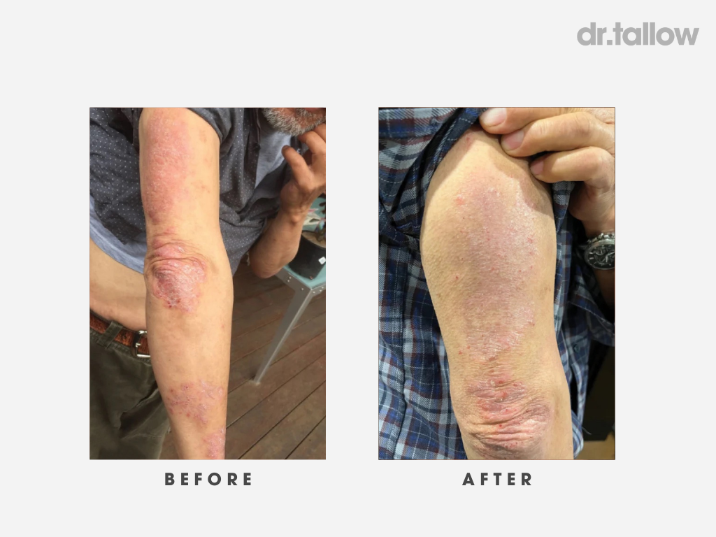 The Original Tallow Balm